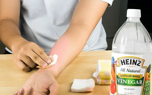 Amazing Vinegar Uses in Gardens and Homes 102