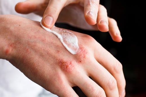 Dawn Dish Soap Uses in the Garden 3