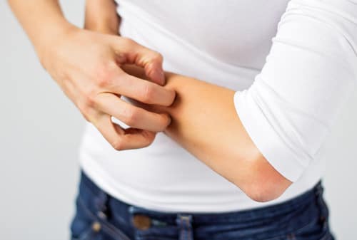 Alleviate Itchy Skin
