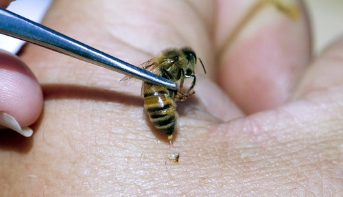 Can Bumble Bees Sting You Repeatedl