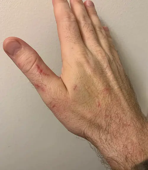 What Does a Ladybug Bite Look Like