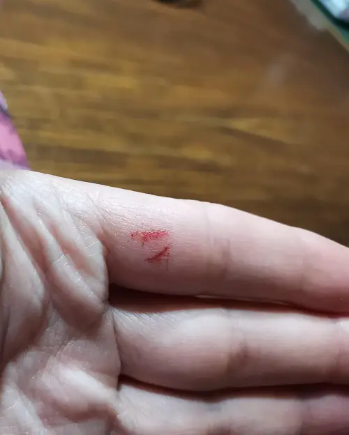 Do Bearded Dragons Bite yes