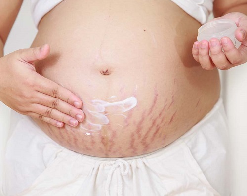 Amazing Things You Can Do With An Aloe Plant take care stretch marks